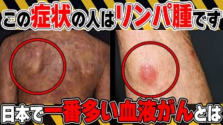 【日本で一番多い血液がん】絶対に見逃さないで！悪性リンパ腫の初期の危険サインとは？予防法についても医師が徹底解説！【医師監修】【悪性リンパ腫は】 [upl. by Enenaj]