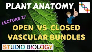 Plant Anatomy 27  Open vs Closed vascular bundles [upl. by Eiuqcaj682]