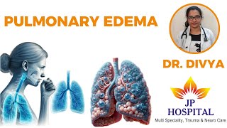 Pulmonary Edema Symptoms Cause and Medication  Dr Divya  JP Hospital [upl. by Alicea87]