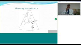 Diagnosis and Management of Coarctation of Aorta by Dr Suresh Kumar [upl. by Kentiga]