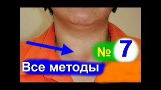 Щитовидная железа 5 Узловой и многоузловой эутиреоидный зоб [upl. by Fesoj]