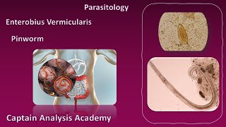 E4 parasitology Enterobius vermicularis الديدان الدبوسية [upl. by Derfnam]