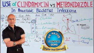 Clindamycin vs Metronidazole  Anaerobic Infection  Pharmacology💊 [upl. by Hosbein]