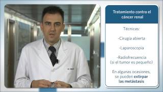 Últimos tratamientos para el cáncer de riñón [upl. by Aleik]