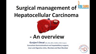 Primary liver cancer  Hepatocellular carcinoma treatment  Dr Gunjan Desai  Edusurg Clinics [upl. by Graf]