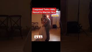 Abby Hensel One of the Conjoined Twins Gets Married viral abby trending [upl. by Guibert624]