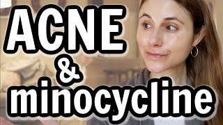 Minocycline versus doxycycline for acne Dr Dray [upl. by Stilwell622]