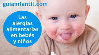 ¿Mi hijo tiene alergia a un alimento  Síntomas de las alergias alimentarias más comunes en niños [upl. by Kremer722]