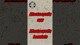 🤔Blastocystis Hominis en Heces Es un QuisteForma Vacuolar ¿Que es Morfologia e Identificacion🔬p2 [upl. by Heall]