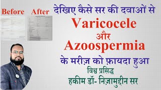 Azoospermia with varicocele successfully treated with unani system of medicine by Dr Nizamuddin Sir [upl. by Hgielrebma]