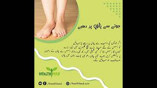 Rashes on feet from shoes  jote sy poan pr dhaby  feet care  skin Care  shorts [upl. by Noryahs]