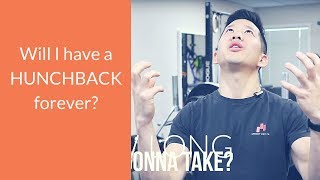 How long does it take to fix hunchback posture [upl. by Gaudet]