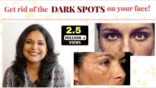 Best Remedies for Hyperpigmentation in 5 minutes  Dermatologist Solutions  ZindagiWithRicha [upl. by Oderfliw387]