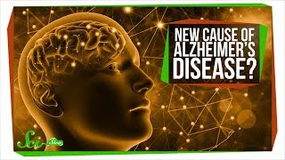 We Might Be Totally Wrong About Alzheimer’s [upl. by Eniala603]