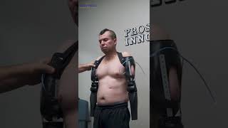 Victor Bilateral TransHumeral Prosthetic Elbow Placement  Prosthetic Innovations [upl. by Boccaj]