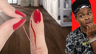 Painful Things And Tik Tok Pranks We Can All Relate To [upl. by Ahsenod]