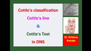 What are Cottles classification Cottles test and Cottles maneuver in DNS drkrishnakoirala [upl. by Thetisa]