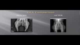 The Importance of quotPrecise Positioning Technique™quot for OFA radiographs for Canine Hip Dysplasia [upl. by Masuh]