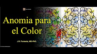 Anomia para el Color [upl. by Anahpos768]