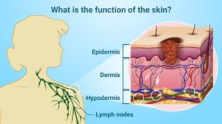 Understanding Melanoma [upl. by Kaia]