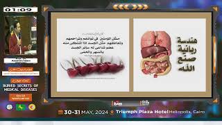 Cardio Hepatic GroupCongestive HepatopathyProf Dr Abdelmonaem Elshamy [upl. by Aniara]