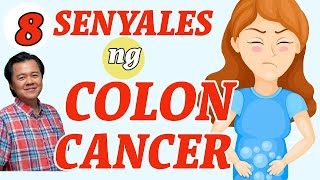 8 Senyales ng Colon Cancer  By Doc Willie Ong [upl. by Godrich]