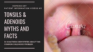 TONSIL AND ADENOID SURGERY MYTHS AND FACTS I TAMIL VERSION I PART 1 [upl. by Demaggio]