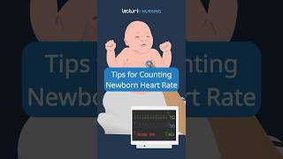 💓 Newborn Heart Rate Tips NursingSkills NewbornCare nclex [upl. by Hukill8]