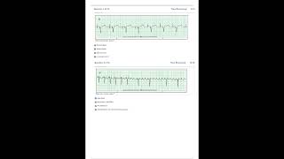 Relias Dysrhythmia Basic Test Answers 2023 Dysrhythmia – Basic A A GRADED 100 VERIFIEDPDF [upl. by Bracci571]