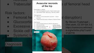 Avascular necrosis of the hip [upl. by Nwahsir]