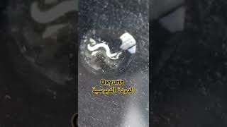 Oxyuris enterobius vermicularis الدودة الدبوسية الاكثر اصابة بين الاطفال shorts firststep [upl. by Lil]