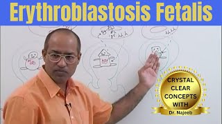 Erythroblastosis Fetalis  Pathophysiology 🩺 [upl. by Nomyad]