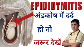 Epididymitis SymptomsCauses And Treatment Homeopathic Medicine Testicular Pain DrRamdeo Lamoria [upl. by Henrion]