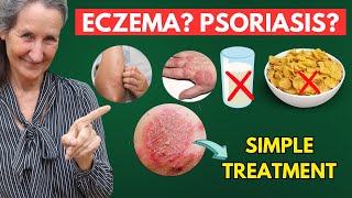 STOP Eating This To Cure all Your Skin Problems Like Eczema Psoriasis  Dr Barbara ONeill [upl. by Ymorej]