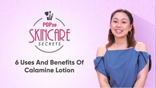 6 Uses And Benefits Of Calamine Lotion  POPxo Skincare Secrets [upl. by Alver]