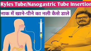 ryles tube insertion nasogastric tube insertion hindi technique NG Tube RT Insertion Dr Satish [upl. by Atoked]