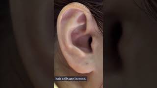 Tinnitus EXPOSED  Surprising Causes of Ringing in Ears 5 [upl. by Pilif175]