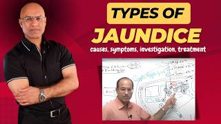 Types Of Jaundice  Causes Symptoms amp Treatment  Dr Najeeb [upl. by Peednus728]