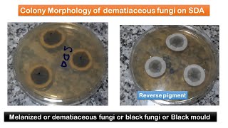 Melanized Fungal growth on SDA and list of black fungi [upl. by Lechar]