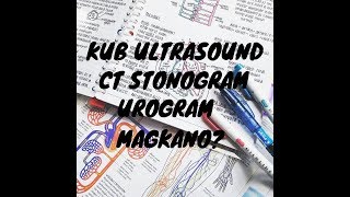 Magkano KUB Ultrasound CT Stonogram at UROGRAM [upl. by Bunni]