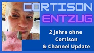 2 Jahre ohne Cortison  Channel Update [upl. by Frere743]