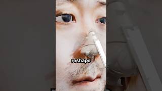 Rhinoplasty Animation  nose job step by step [upl. by Duwe742]