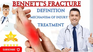 The Ultimate Guide to Bennetts Fracture Treatment Secrets [upl. by Koenraad]