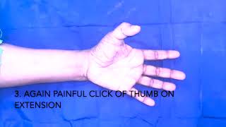 Trigger Thumb surgery  Nair Hospital  Hand Surgery Dr Mangesh Pawar [upl. by Lletnahs]