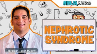 Nephrotic Syndrome [upl. by Nazus]