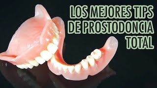 MEJORES TIPS DE PROSTODONCIA TOTAL [upl. by Attey]