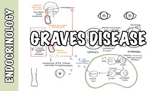 Graves Disease  Overview causes pathophysiology investigations and treatment [upl. by Ciel]