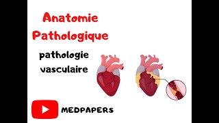 anatomie pathologique pathologie vasculaire [upl. by Hanikehs]