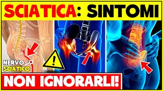 Segni e Sintomi Della Sciatica Come Riconoscere Il Nervo Sciatico Infiammato  Sciatalgia Sintomi [upl. by Fortna]