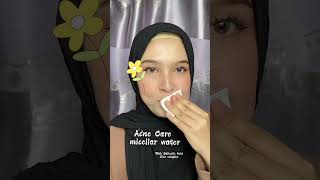 Rekomendasi Micellar Water Untuk Acne Prone [upl. by Eerak]